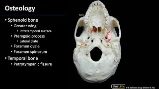 Infratemporal Fossa - Osteology