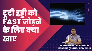 टूटी हड्डी को Fast जोड़ने  के लिए क्या खाए /Dr. Pradeep Kumar Singh