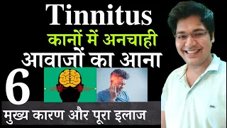 Tinnitus कानों में अनचाही आवाजों का आना,6 मुख्य कारण और पूरा इलाज