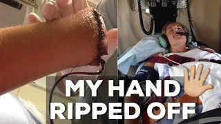 The Day I Almost Died // My Hand Ripped Off  *STORY TIME*