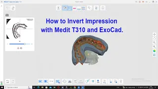 How to Invert Impression with Medit T310 and ExoCad.