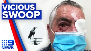Man undergoes surgery after vicious magpie attack | 9 News Australia