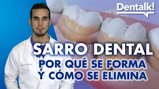 DIENTES con SARRO - CÓMO SE QUITA, previene y por qué se forma el sarro dental | Dentalk! ©