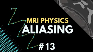 Aliasing (Wraparound) Artifact and Parallel Imaging in MRI | MRI Physics Course #13