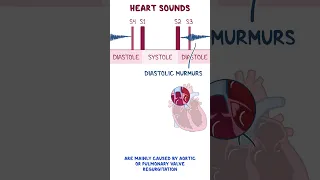 Clinical Cuts: Abnormal heart sounds