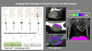 3MT 2019 - Olivia Sehl: Breast cancer should be easy to find ...
