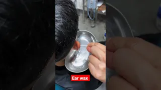 How to Remove Ear Wax #youtubeshorts #creatingforindia