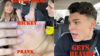 HICKEY PRANK ON BOYFRIEND *HE GETS ANGRY*