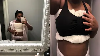 BREAST REDUCTION VLOG | Full recovery included I-C cup | YEMI ASHIANNA