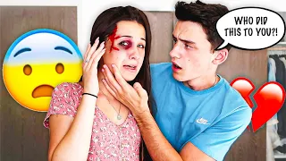 I GOT BEAT UP PRANK ON FIANCE! *CUTE REACTION*