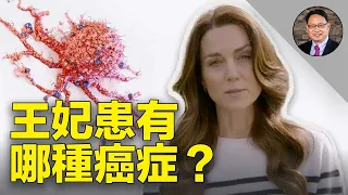 50歲以下女性易患哪些癌症？ 有一種癌症最值得所有人的警覺！