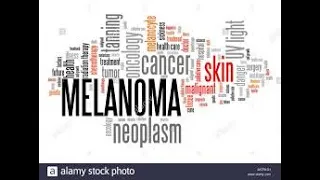 Skin Cancers- Types,Symptoms,Causes,Treatments,Diagnosis,Screening,Stages,Prevention ,Complications