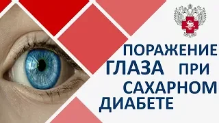 Сахарный диабет и зрение. 👁 Диагностика и лечение зрения при сахарном диабете. Пироговский центр.