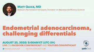 Endometrial adenocarcinoma, challenging differentials - Dr. Quick (UAMS) #GYNPATH