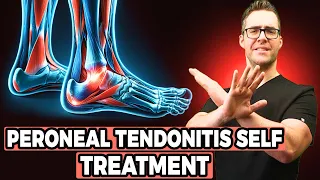 Peroneal Tendonitis Self Treatment [Stretches, Exercises & Massage]