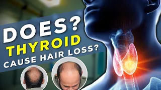 Thyroid Hair Loss| Does Thyroid Causes Hair Loss