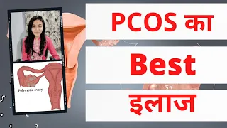 Pcod homeopathic treatment | Pcod homeopathy medicine |  Pcos homeopathy treatment | Pcos treatment