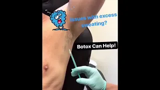 Botox срещу изпотяване под мишници