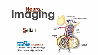 1 Imaging of sella (part 1) - prof.Mamdouh Mahfouz (2019 edition)