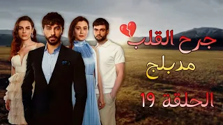 مسلسل جرح القلب مدبلج - الحلقة 19 HD