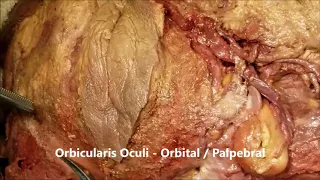 FACE MUSCLES MODIOLUS MASSETER PAROTID BUCCAL FAT and Clinical Aspects – Sanjoy Sanyal