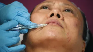 East Asian Full Facial Rejuvenation Course | Cosmetic Courses