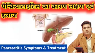 What is Pancreatitis? What are Causes Symptoms and Treatments of it