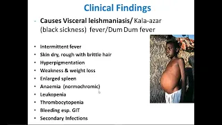 Leishmania and Trypanosoma lecture