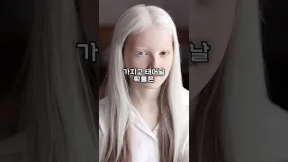 3억분의 1 확률로 태어난 신비한 소녀