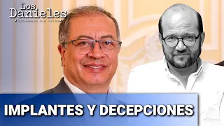 Los implantes capilares del presidente: una reforma sin éxito | Daniel Samper Ospina