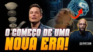 Urgente! Elon Musk implanta chip no cérebro do primeiro humano!