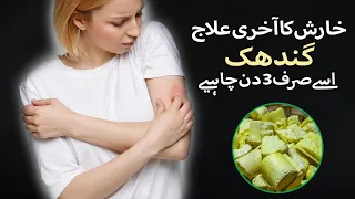 Kharish خارش (Itching)  کھجلی Ka ilaj | Kharish Khatam Krne Ka Tarika