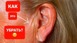 КАК УБРАТЬ морщины возле уха