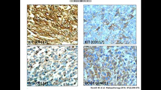 Mutational Testing of GISTs: How, When and Why