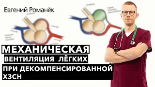 Механическая вентиляция лёгких при декомпенсированной ХЗСН