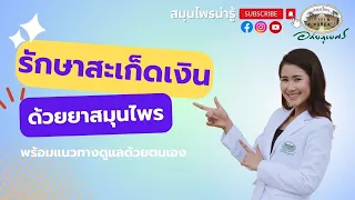 สะเก็ดเงิน เทคนิคการดูแลรักษาด้วยสมุนไพร l สมุนไพรน่ารู้ (2023)