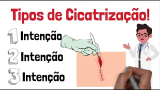 Tipos de Cicatrização de Feridas - Cicatrização por primeira intenção, segunda intenção