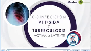 modulo 5 - VIH y Tuberculosis: CURSO SITUACIONES ESPECIALES VIH