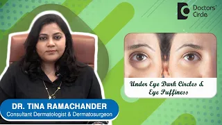 How to get rid of PUFFY EYES AND DARK CIRCLES ? - Dr.Tina Ramachander | Doctors' Circle
