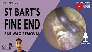 748 - St Bart's Ear Wax Removal and Fine End Suction Skin Peel
