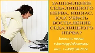 Защемление седалищного нерва. Ишиас. Как убрать воспаление седалищного нерва?