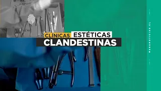 Cirugías estéticas clandestinas: Los peligros de la "mini lipo"