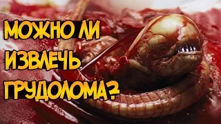 Можно ли извлечь грудолома хирургическим путем? (Чужие / Ксеноморфы)