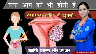 योनि में जलन खुजली और इंफेक्शन के कारण और इसके घरेलू उपाय | Home Remedy for Vaginal Itching