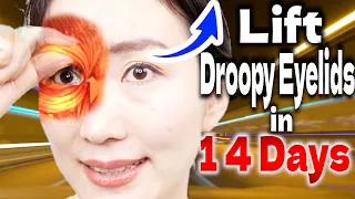 Do this Before Seeing Friends! Ultimate Massage to Lift Droopy Eyelids in 14 Days