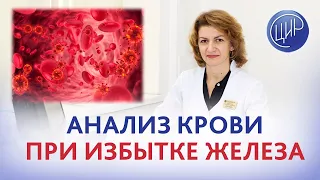 Анализ крови в 23 недели беременности. Избыток железа. Дементьева С.Н.