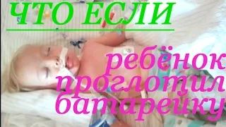 ►#ЧТО БУДЕТ #ЕСЛИ #РЕБЕНОК ПРОГЛОТИЛ #БАТАРЕЙКУ #чтоесли #What happens #if  child swallows a battery