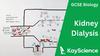 Kidney Dialysis - Biology GCSE | kayscience.com