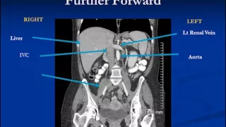 Abdomen Review