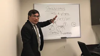 Strabismus without diplopia